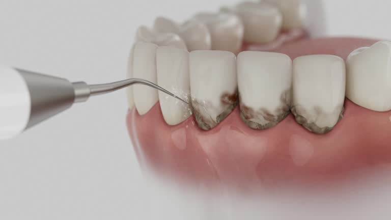 Trusted Teeth Cleaning And Checkup service in Cornelius, OR - Dentist Open Now